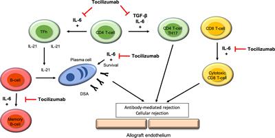 Tocilizumab and Active Antibody-Mediated Rejection in Kidney Transplantation: A Literature Review